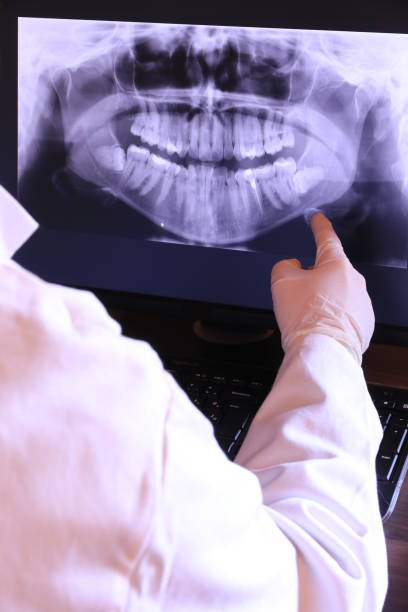 Best Emergency Dental Care for Broken or Chipped Teeth in Belle Plaine, IA