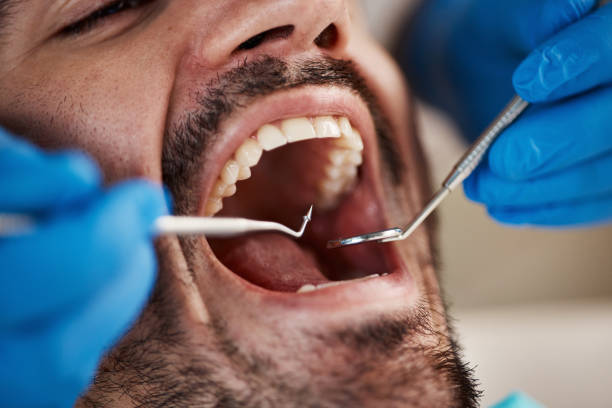 Best Urgent Care for Lost Fillings or Crowns in Belle Plaine, IA